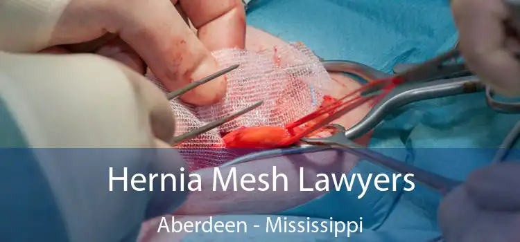 Hernia Mesh Lawyers Aberdeen - Mississippi