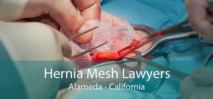 Hernia Mesh Lawyers Alameda - California