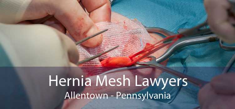 Hernia Mesh Lawyers Allentown - Pennsylvania