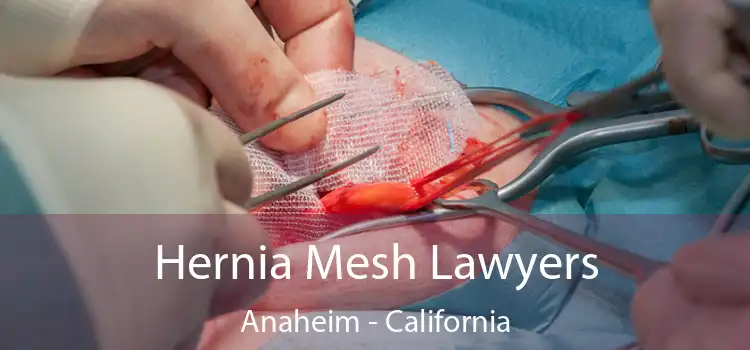 Hernia Mesh Lawyers Anaheim - California