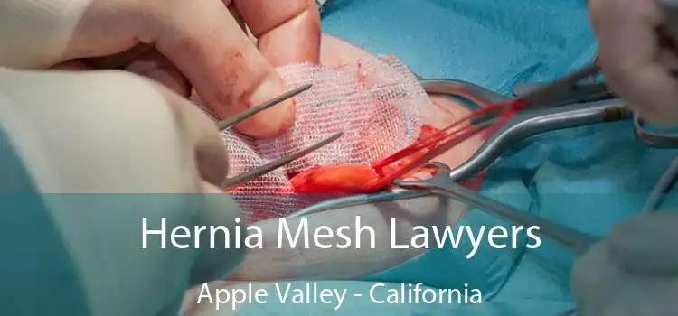 Hernia Mesh Lawyers Apple Valley - California