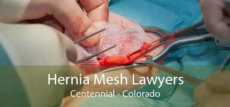 Hernia Mesh Lawyers Centennial - Colorado