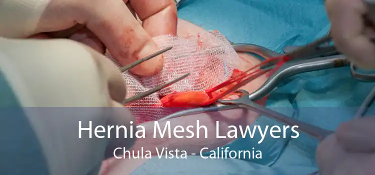 Hernia Mesh Lawyers Chula Vista - California
