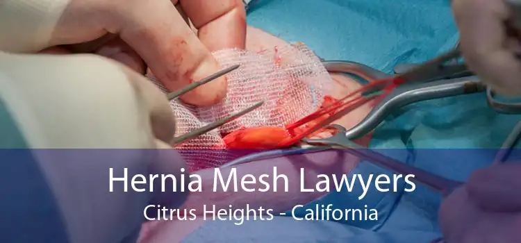 Hernia Mesh Lawyers Citrus Heights - California