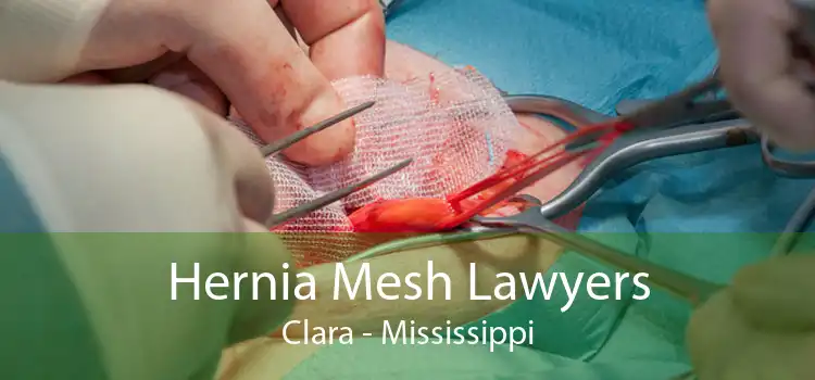Hernia Mesh Lawyers Clara - Mississippi