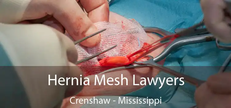 Hernia Mesh Lawyers Crenshaw - Mississippi