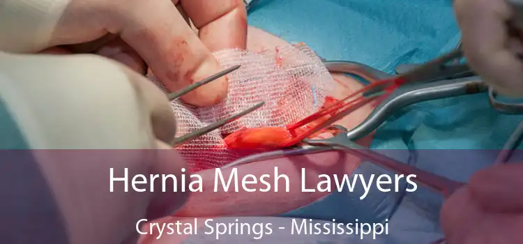 Hernia Mesh Lawyers Crystal Springs - Mississippi