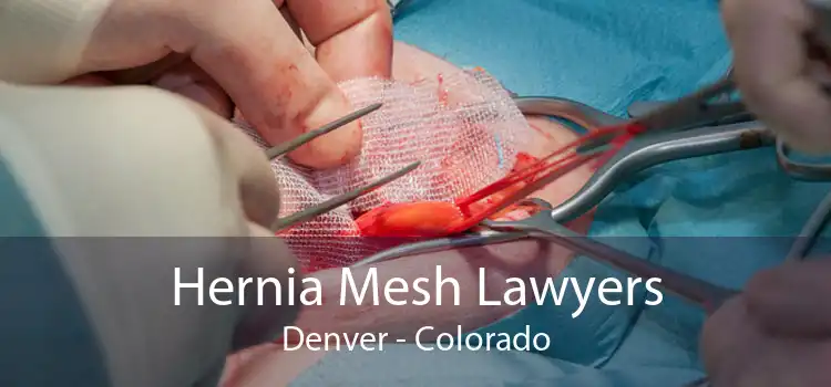 Hernia Mesh Lawyers Denver - Colorado