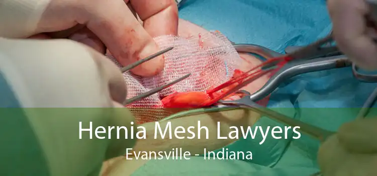 Hernia Mesh Lawyers Evansville - Indiana