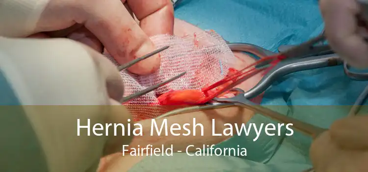 Hernia Mesh Lawyers Fairfield - California