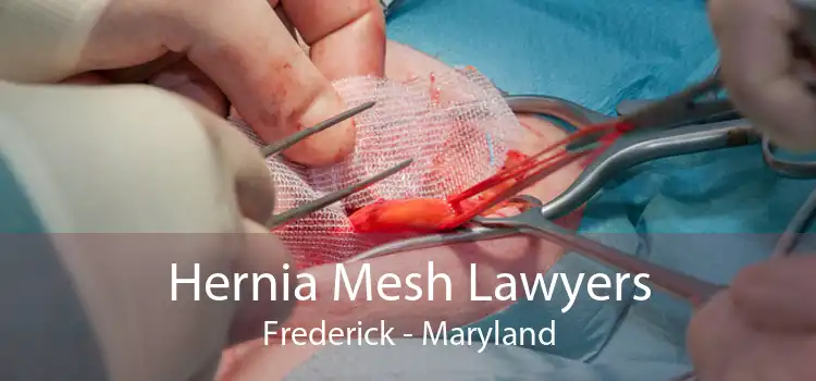 Hernia Mesh Lawyers Frederick - Maryland