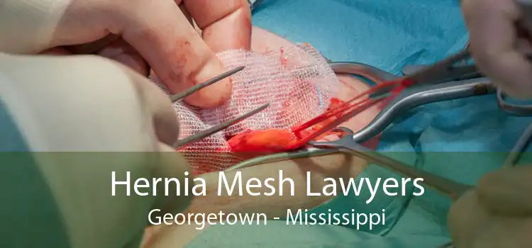 Hernia Mesh Lawyers Georgetown - Mississippi