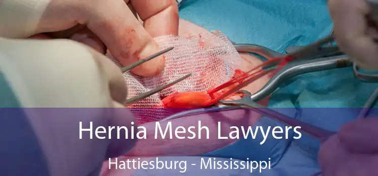 Hernia Mesh Lawyers Hattiesburg - Mississippi