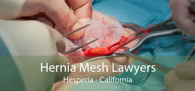 Hernia Mesh Lawyers Hesperia - California