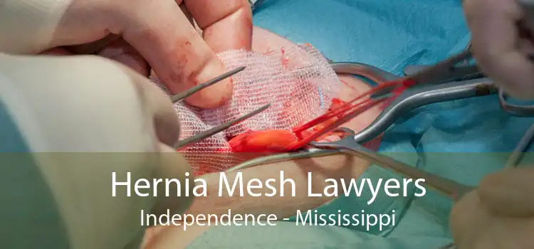 Hernia Mesh Lawyers Independence - Mississippi
