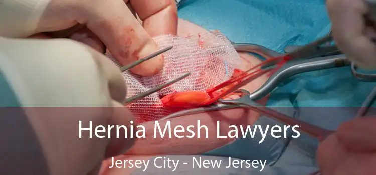 Hernia Mesh Lawyers Jersey City - New Jersey