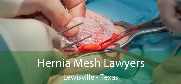 Hernia Mesh Lawyers Lewisville - Texas