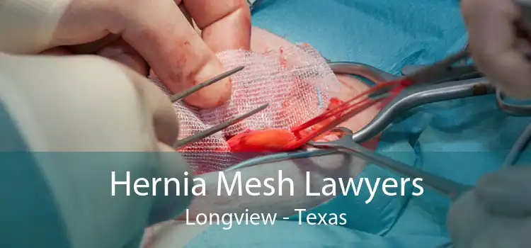Hernia Mesh Lawyers Longview - Texas