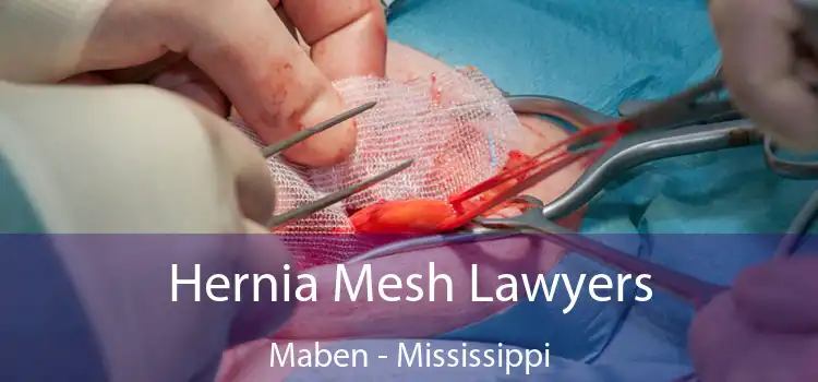 Hernia Mesh Lawyers Maben - Mississippi