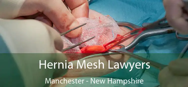 Hernia Mesh Lawyers Manchester - New Hampshire