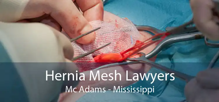 Hernia Mesh Lawyers Mc Adams - Mississippi