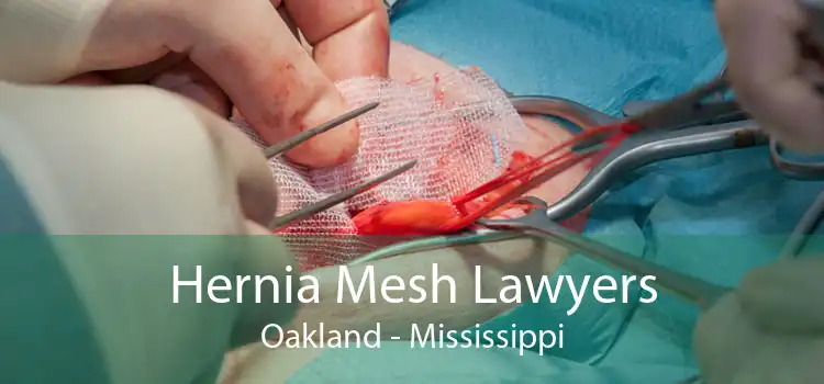 Hernia Mesh Lawyers Oakland - Mississippi