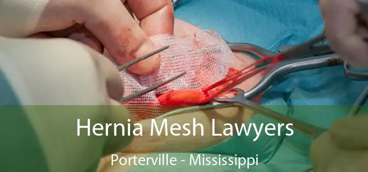 Hernia Mesh Lawyers Porterville - Mississippi