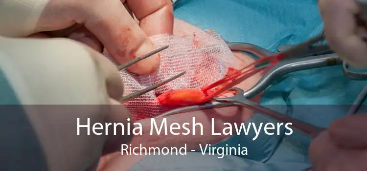 Hernia Mesh Lawyers Richmond - Virginia