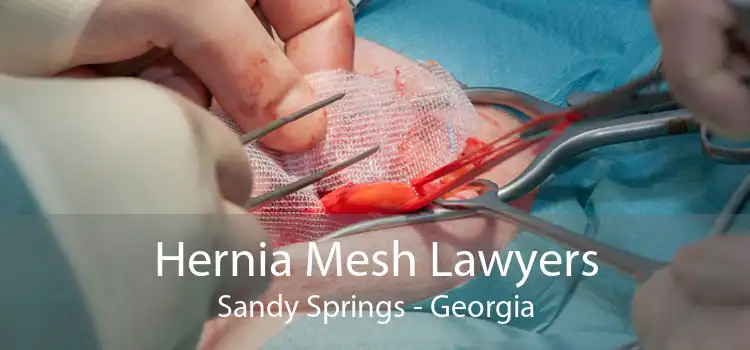 Hernia Mesh Lawyers Sandy Springs - Georgia