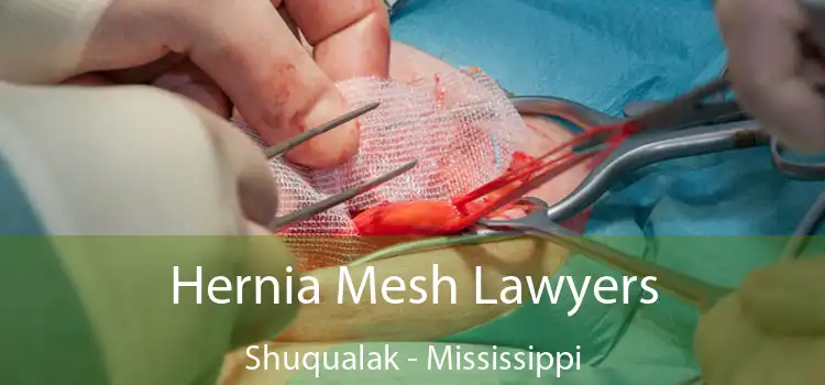 Hernia Mesh Lawyers Shuqualak - Mississippi