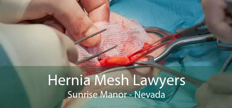 Hernia Mesh Lawyers Sunrise Manor - Nevada