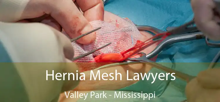 Hernia Mesh Lawyers Valley Park - Mississippi