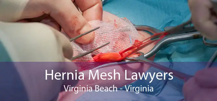 Hernia Mesh Lawyers Virginia Beach - Virginia